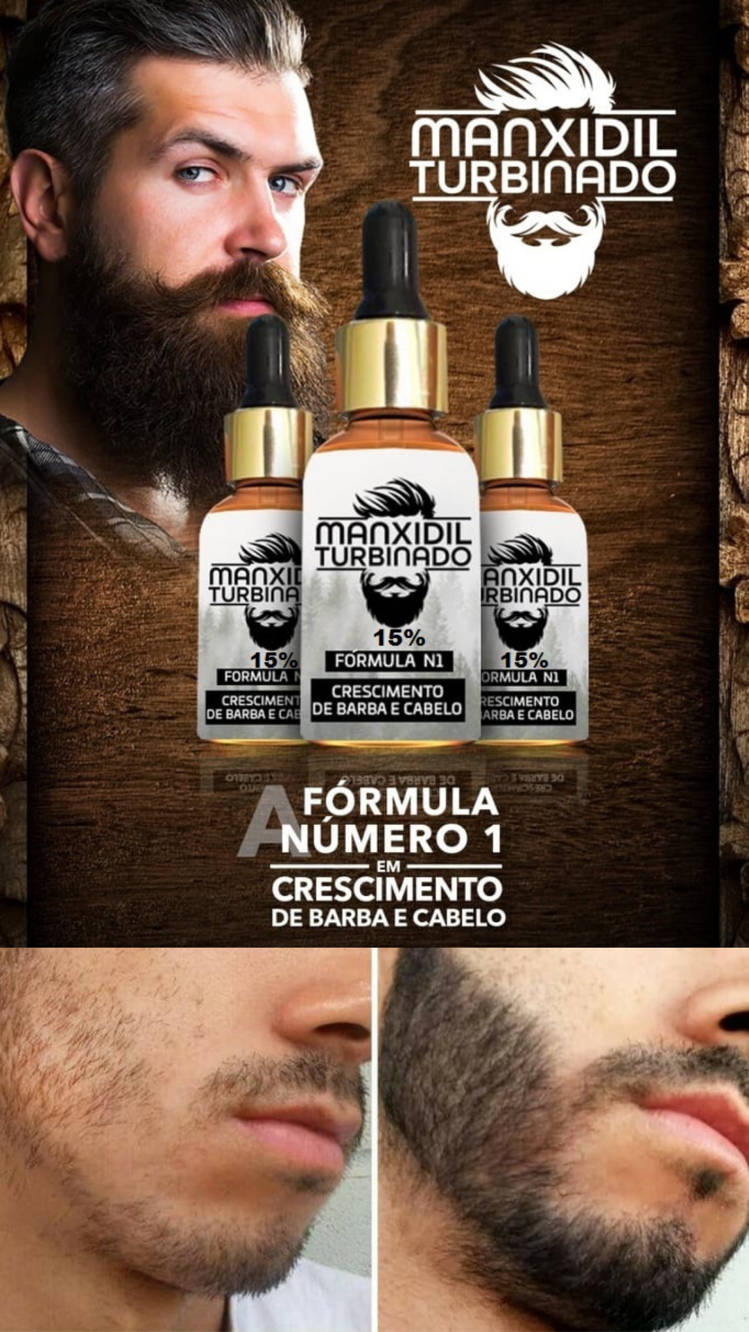 minoxidil barba, minoxidil cabelo e sobrancelha, manxidil turbinado, produto para crescer barba e cabelo