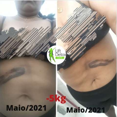 imagem:  lift detox caps antes e depois, lift detox caps bula, lift detox caps contraindicações, lift detox caps para que serve, lift detox caps reclamações, lift detox caps como tomar, lift detox caps como funciona, lift detox caps preço,